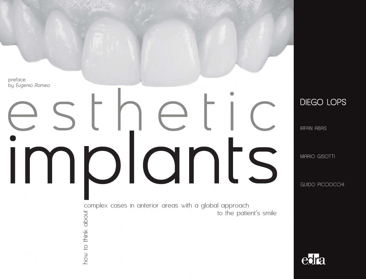 Esthetic Implants How to think about complex cases in anterior areas with a global approach to the patient smile