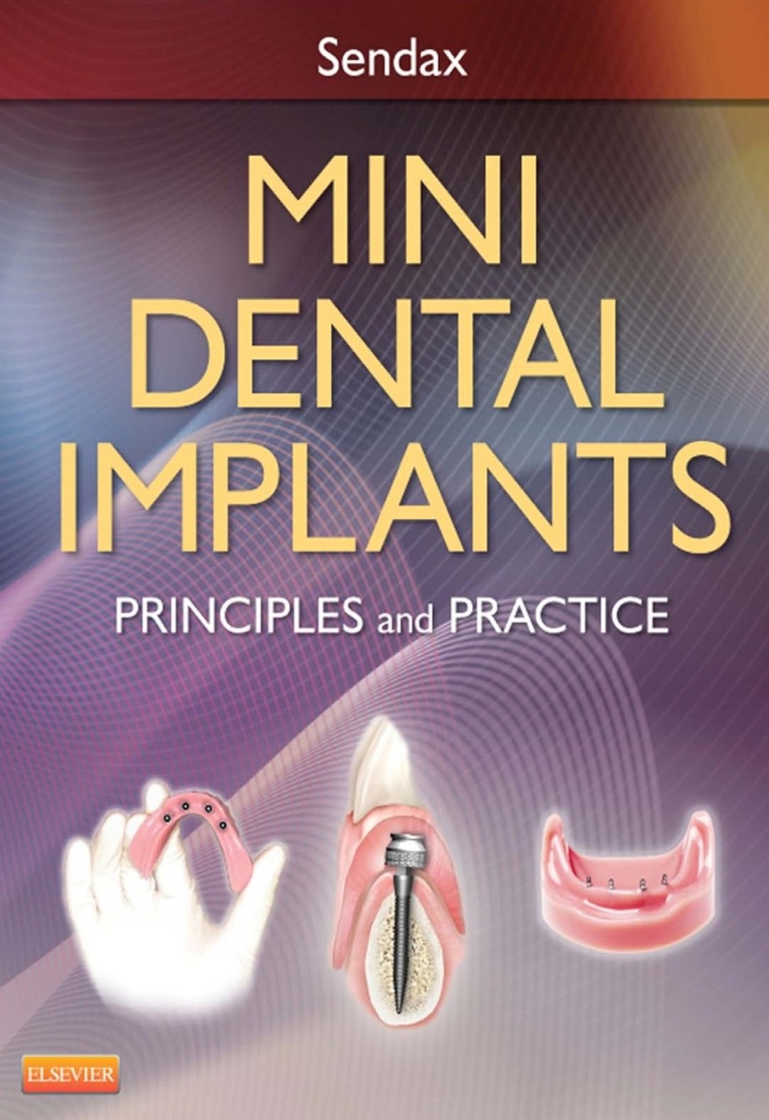 Mini dental implants : principles and practice