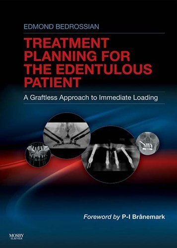 Implant treatment planning for the edentulous patient : a graftless approach to immediate loading