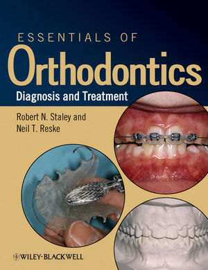 Essentials of Orthodontics Diagnosis and Treatment