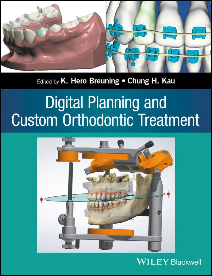 Digital Planning and Custom Orthodontic Treatment, First Edition