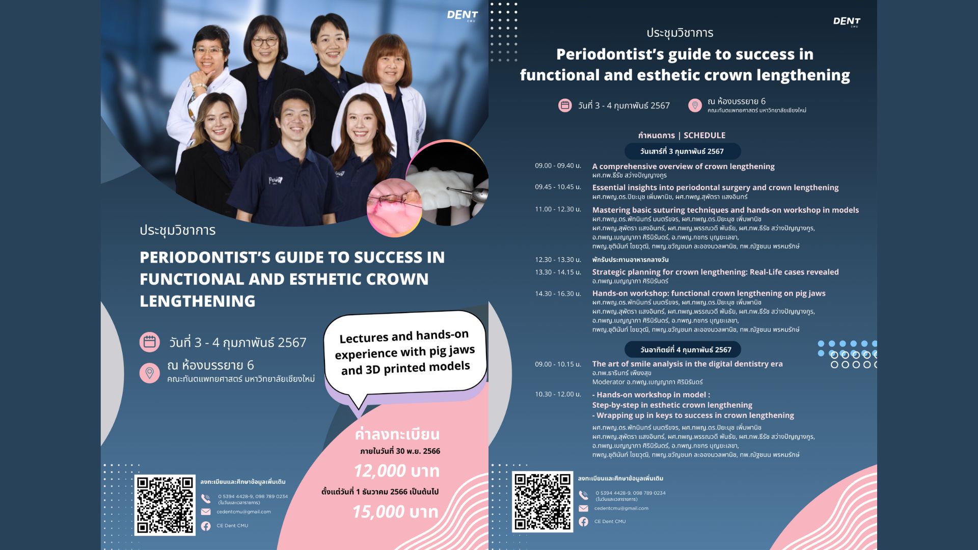 (ปิดรับลงทะเบียน) โครงการประชุมวิชาการ เรื่อง “Periodontist’s guide to success in functional and esthetic crown lengthening”