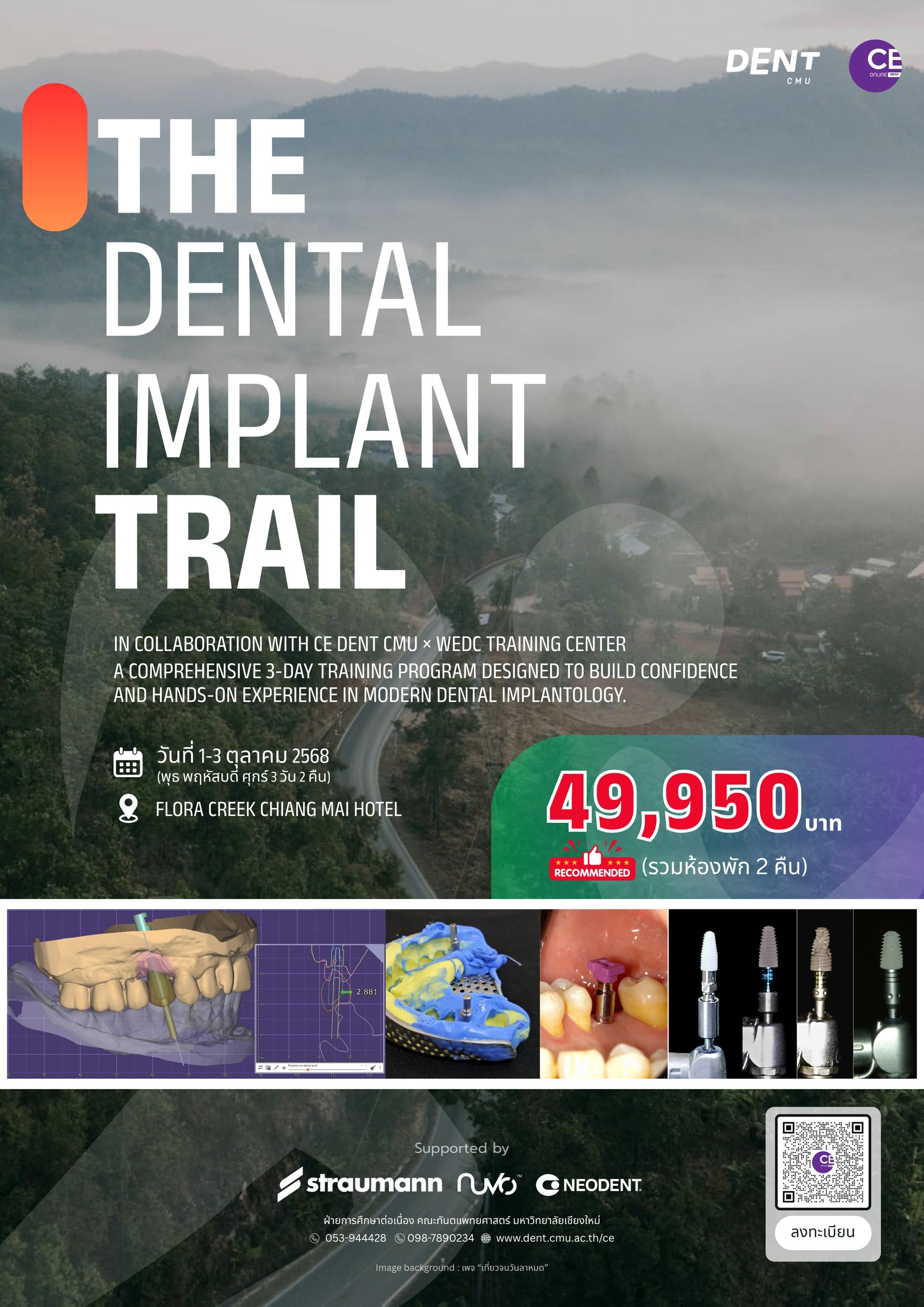 (ปิดระบบลงทะเบียน) โครงการฝึกอบรมระยะสั้น เรื่อง  “The Dental Implant Trail” ภารกิจพิชิตการรักษาโดยรากฟันเทียม