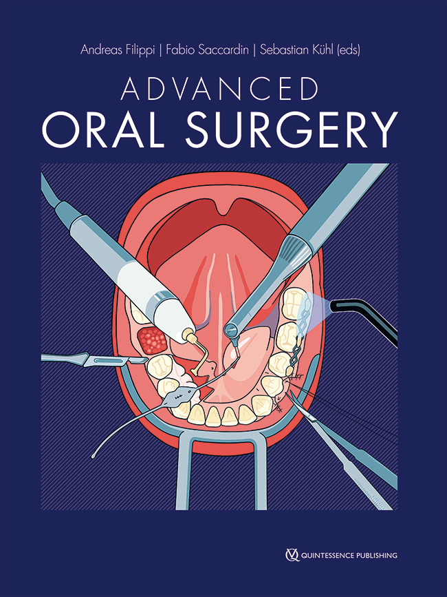 Advanced oral surgery