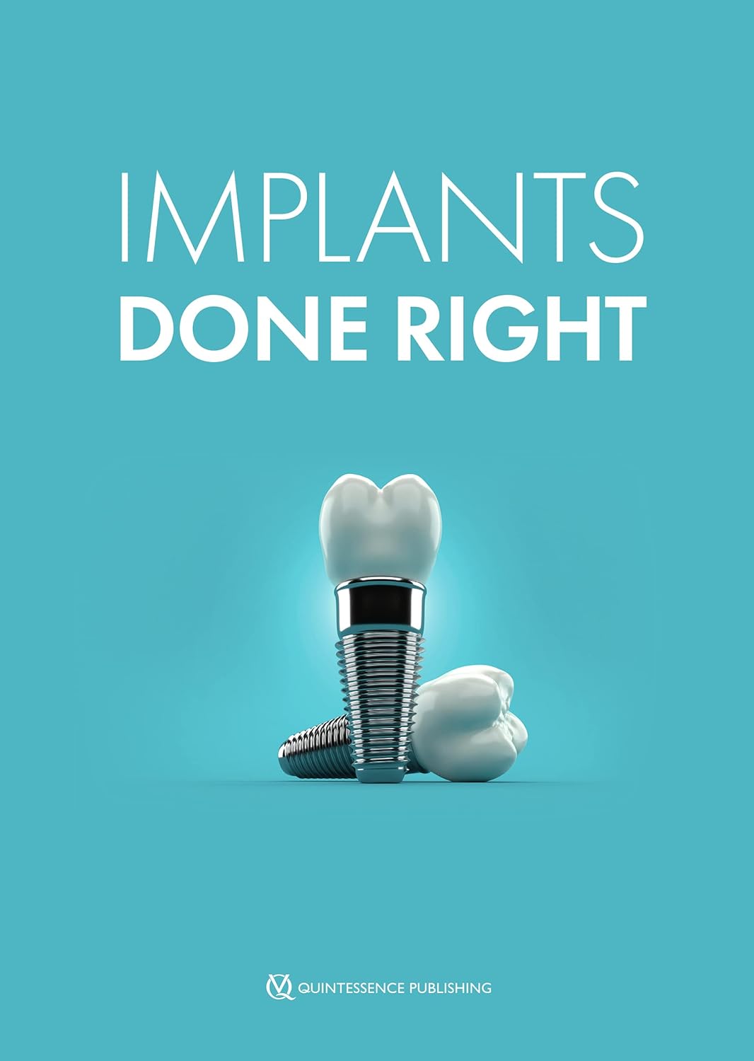Implants Done Right: Your Guide to a Healthy Smile
