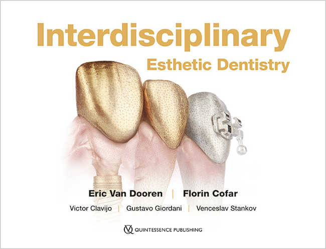 Interdisciplinary esthetic dentistry the big picture