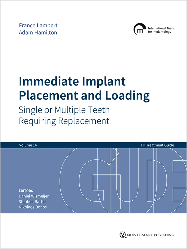 Immediate Implant Placement and Loading – Single or Multiple Teeth Requiring Replacement (ITI Treatment Guide Series, Volume 14)