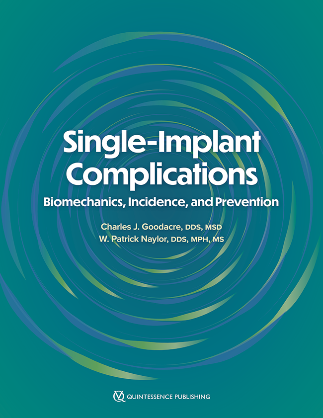 Single-implant complications : biomechanics, incidence, and prevention