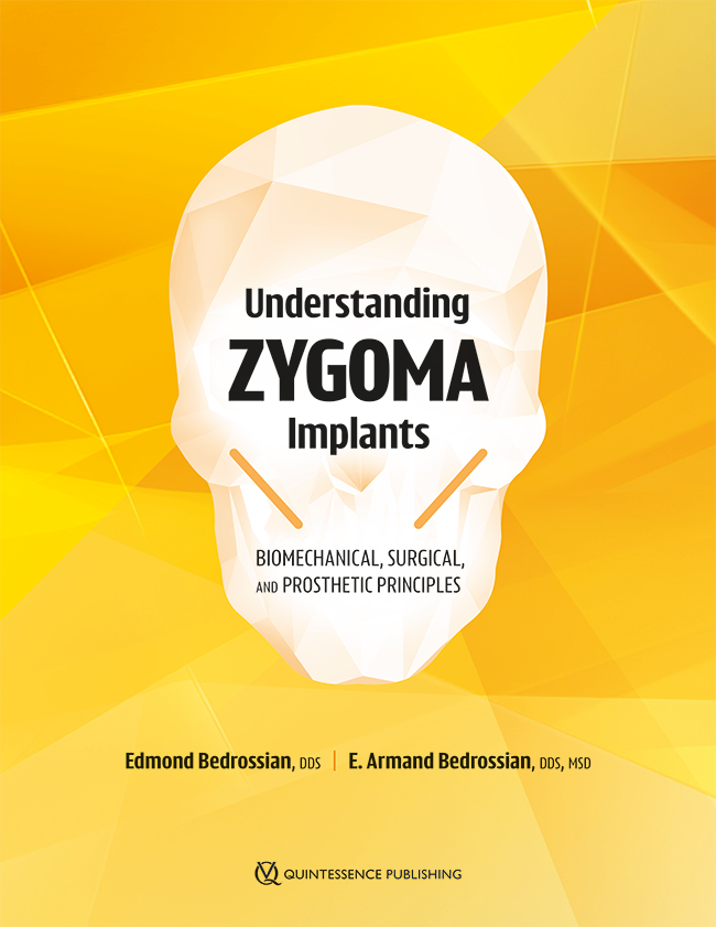Understanding zygoma implants : biomechanical surgical and prosthetic principles