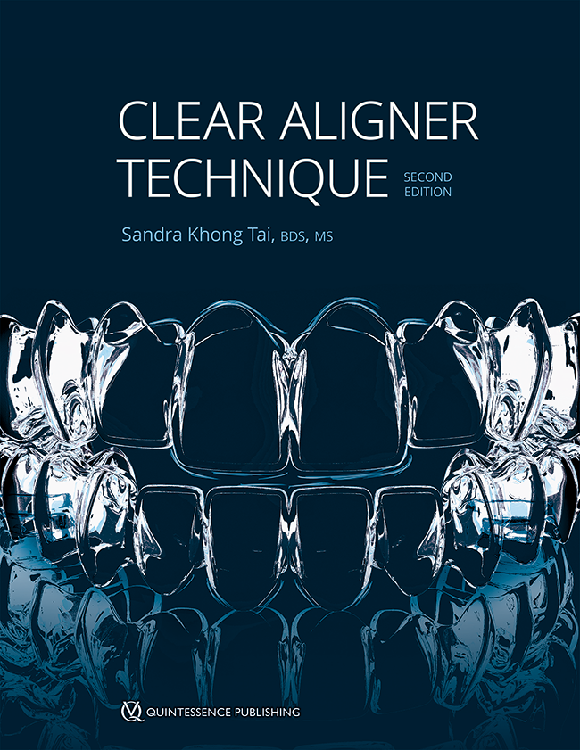 Clear aligner technique