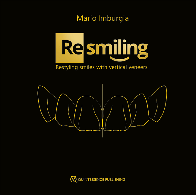 (Re)smiling : restyling smiles with vertical veneers
