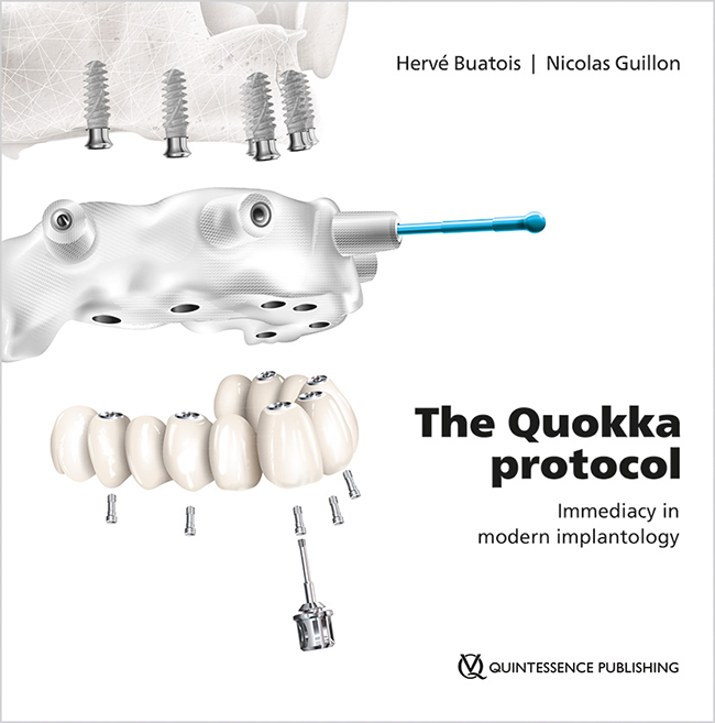 The Quokka protocol Immediacy in modern implantology