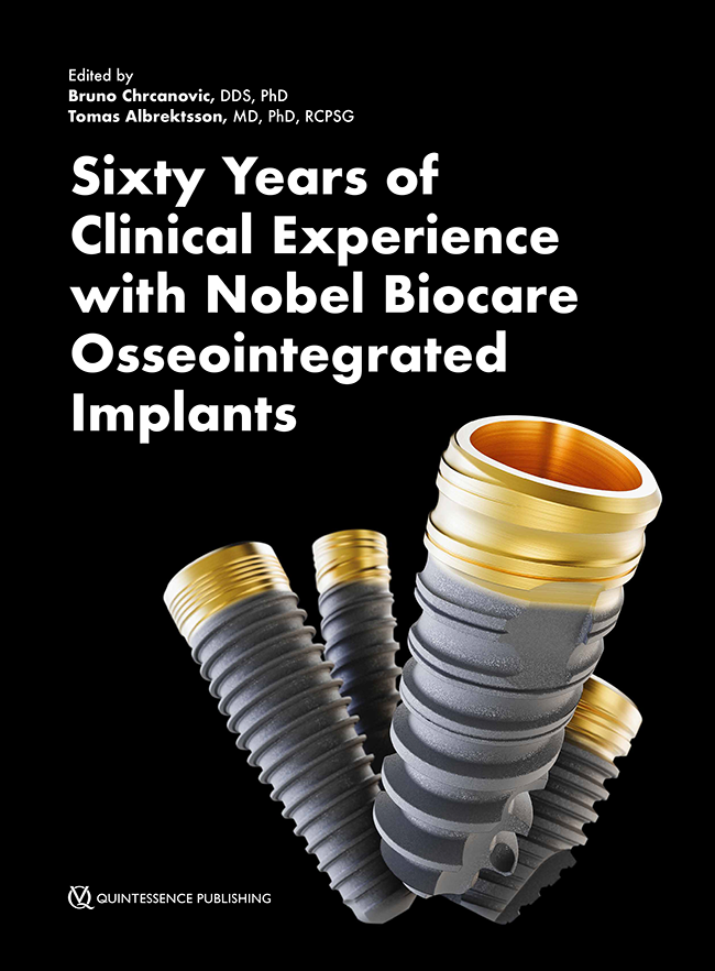  Sixty years of clinical experience with nobel biocare osseointegrated implants. 