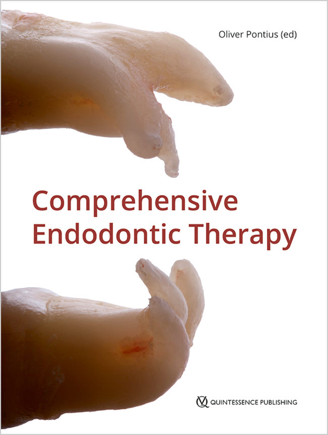 Comprehensive endodontic therapy 