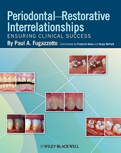 Periodontal-Restorative Interrelationships: Ensuring Clinical Success