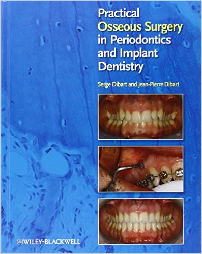 Practical Osseous Surgery in Periodontics and Implant Dentistry