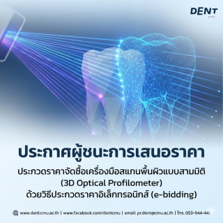 ประกาศผู้ชนะการเสนอราคา ประกวดราคาจัดซื้อเครื่องมือสแกนพื้นผิวแบบสามมิติ (3D Optical Profilometer) ด้วยวิธีประกวดราคาอิเล็กทรอนิกส์ (e-bidding)