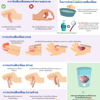 การทำความสะอาดฟันเทียม (สำหรับบุคคลทั่วไป)