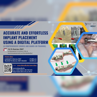 Accurate and Effortless Implant Placement Using A Digital Platform